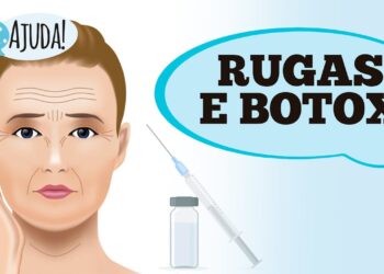 Dr. Ajuda: rugas e botox