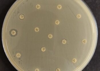 Risco global: bactéria multirresistente é encontrada em paciente brasileira
