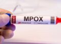 Mpox: Brasil registra 88 casos em seis estados e no DF em 2026; saiba mais sobre a doença