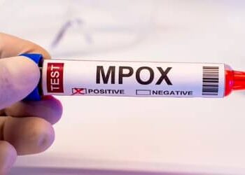 Mpox: Brasil registra 88 casos em seis estados e no DF em 2026; saiba mais sobre a doença