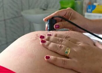 Parto normal é preferência de 70% das brasileiras no início da gravidez; campanha reforça autonomia e informação para gestantes